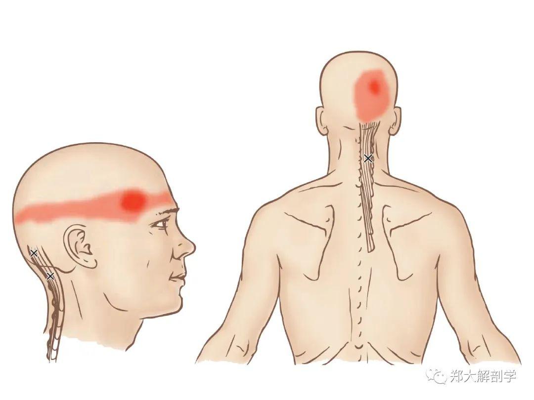 后脑疼痛