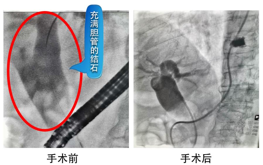 蓬溪县有多少人口2020