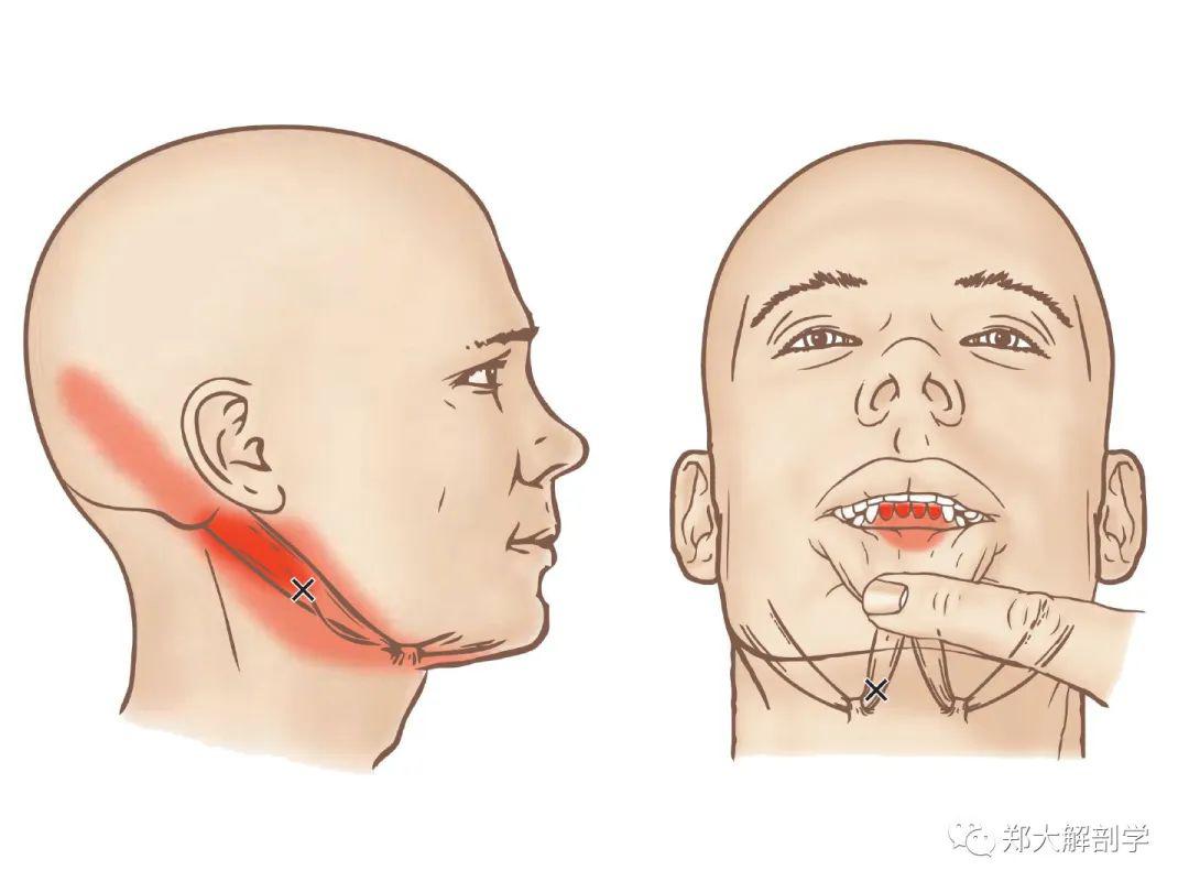 颞肌的扳机点会导致头部前面和侧面的疼痛.