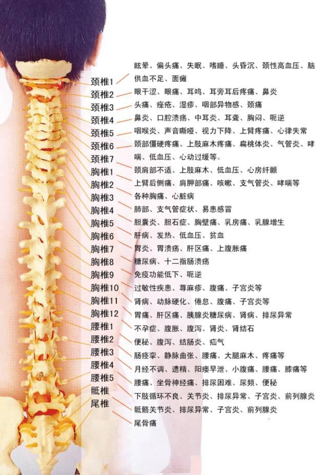脊椎引起的108种疾病
