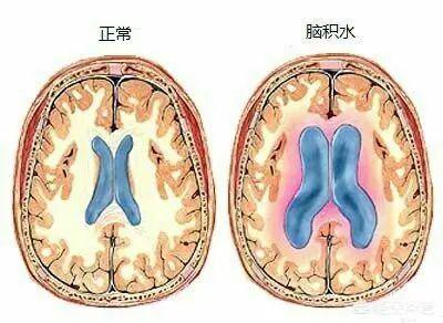什么时候是胎儿畸形的易感期?常见的畸形有哪些?如何避免?
