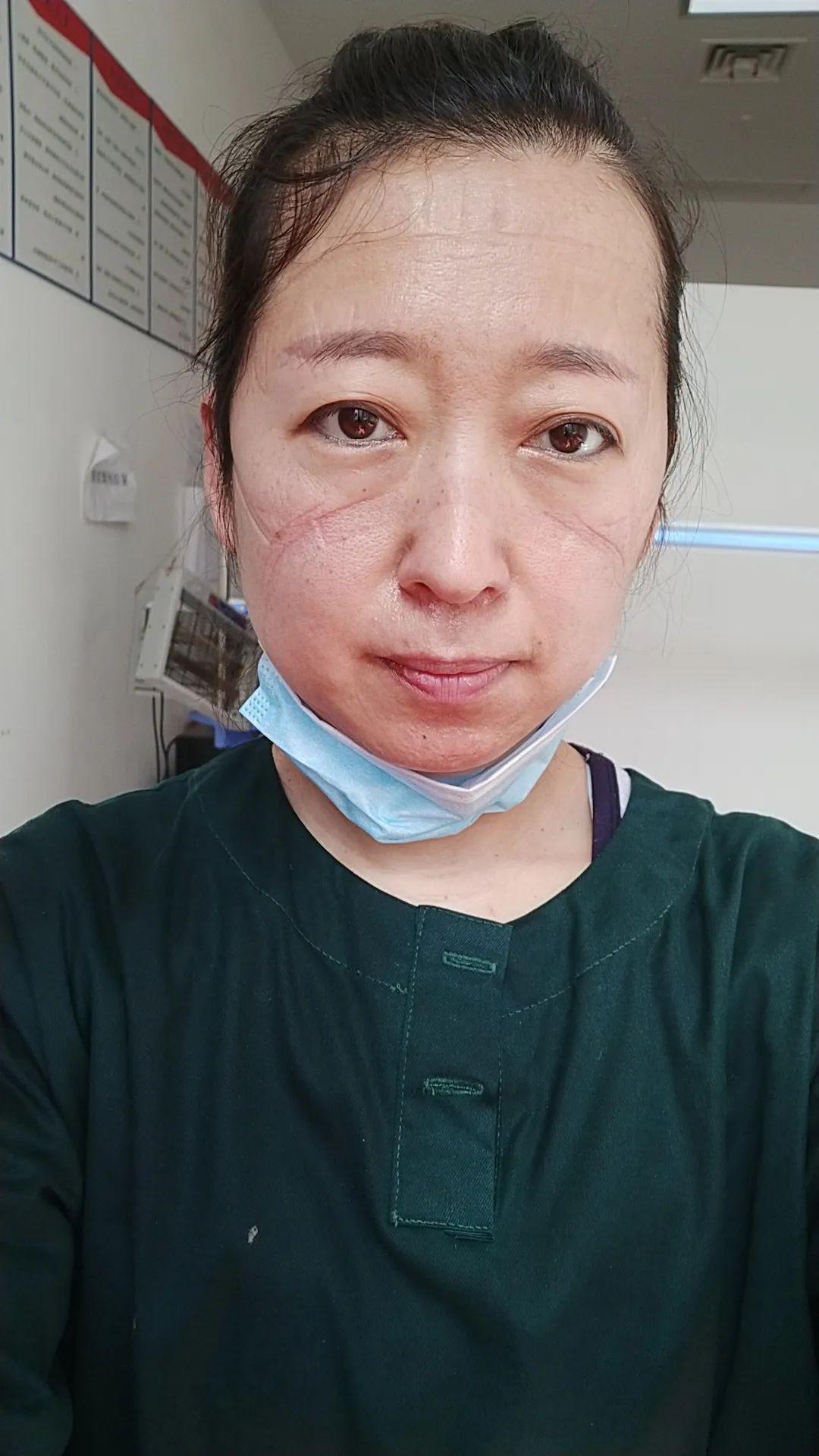 [湖北]面对心疼她而流泪的老公，她毅然选择出发…