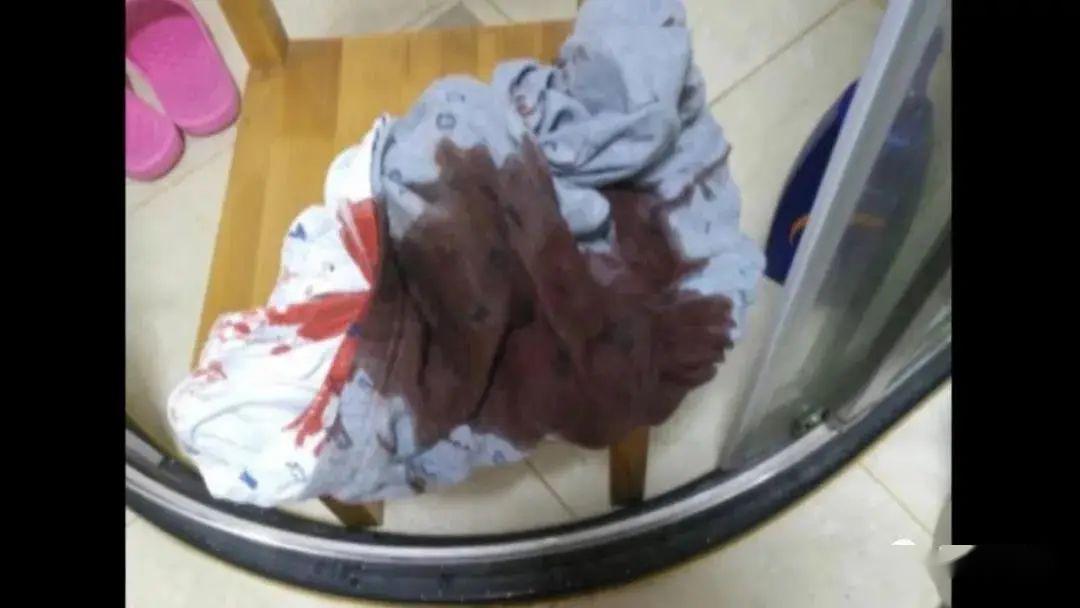 『床单』竟是这个东西掉出来了…“血都是飙出来的！”8岁男童半夜血染床单