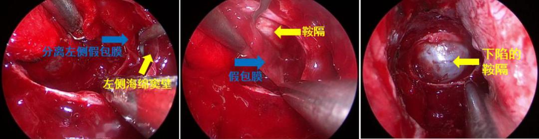 一医青年专家说科普④丨神经外科苏志鹏越长越丑是