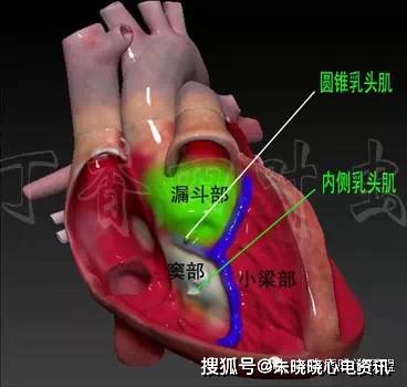 3d心脏解剖,看看心脏到底啥模样?