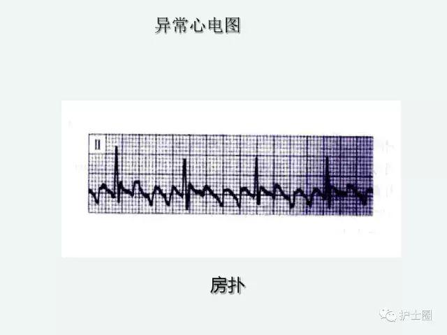 3e2e5804f16f444ab83d4e8fe2c417e4.jpeg
