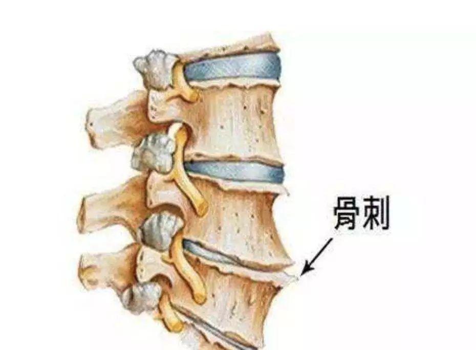 <a href=http://www.52fukang.com/ysdt/ target=_blank class=infotextkey>颈椎病</a>示意图