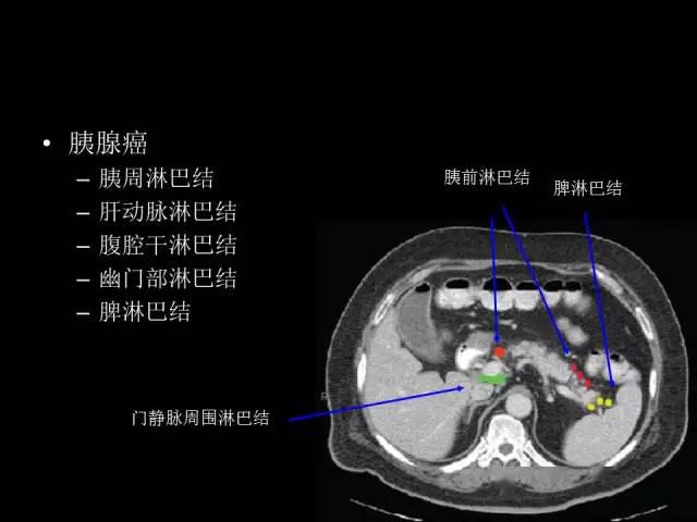 腹部淋巴结影像解剖彩色高清图谱