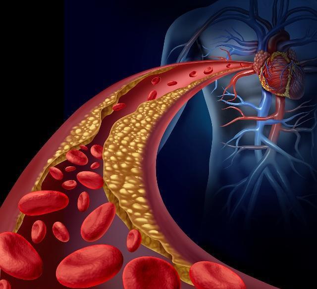 什么原因会引起心脏水肿 c87e7bd6c1a94efd8f89ce1fe87ccc0e.jpeg