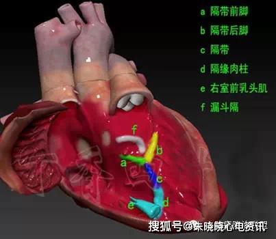 3d心脏解剖,看看心脏到底啥模样?