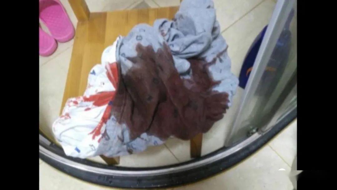 「床单」竟是这东西掉出来……“血都是飙出来的！”8岁男童半夜血染床单