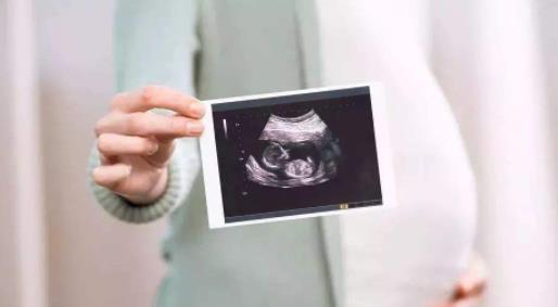 什么时候检查四维彩超 47e33b41500747b690ab0f5b4d7c33cf.jpeg