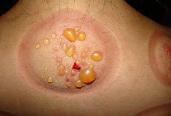 如何防止大便粘马桶 4ce98f60cc7f4017920eff25a101f974.jpeg