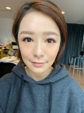 女星右眼大片淤血，药师急打家暴专线，带伤拍