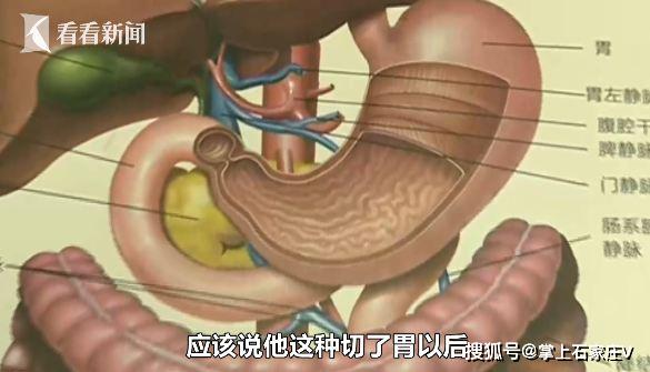 多少斤可以切胃 c72127b72e5b40a4b177f647755a9643.jpeg