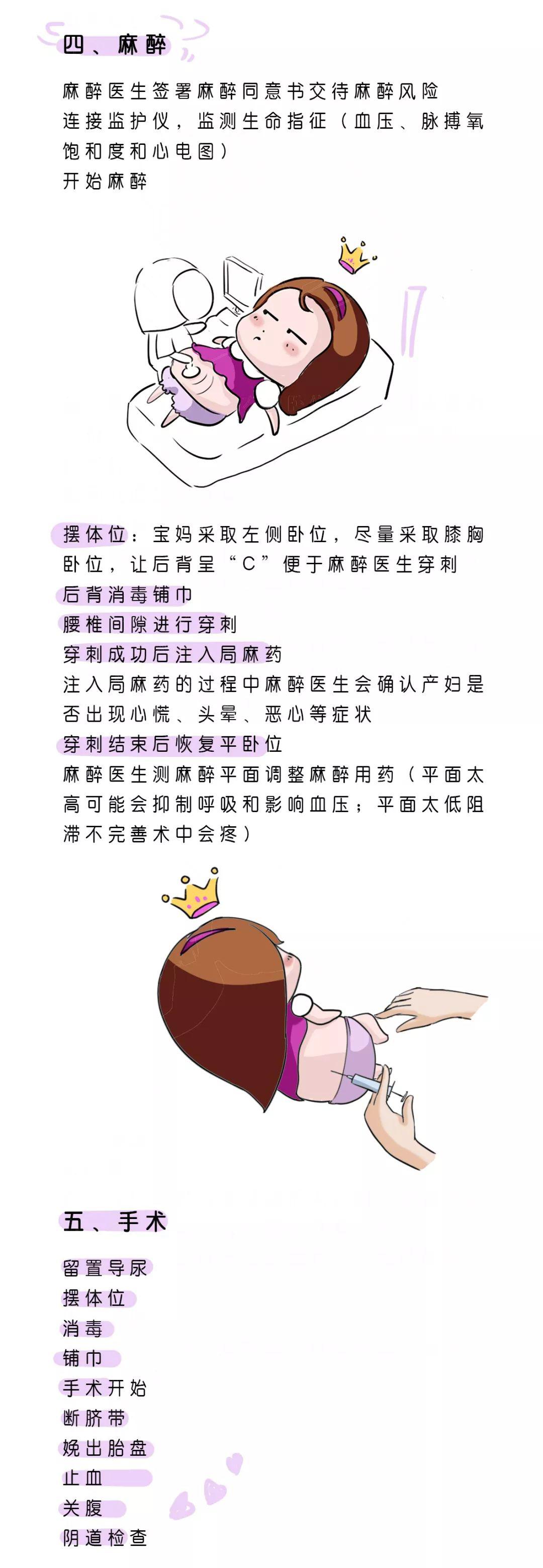 微漫画 | 超实用!剖宫产术前至术后流程图