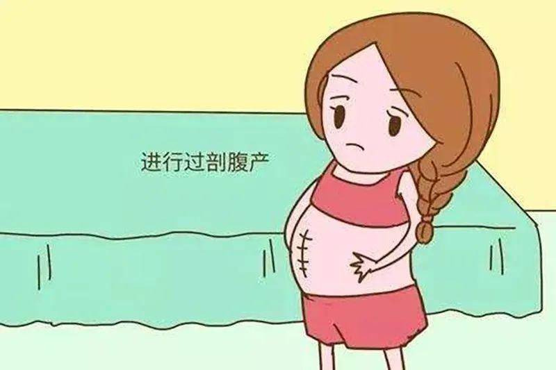 一胎剖宫产,二胎我想顺,可以吗?