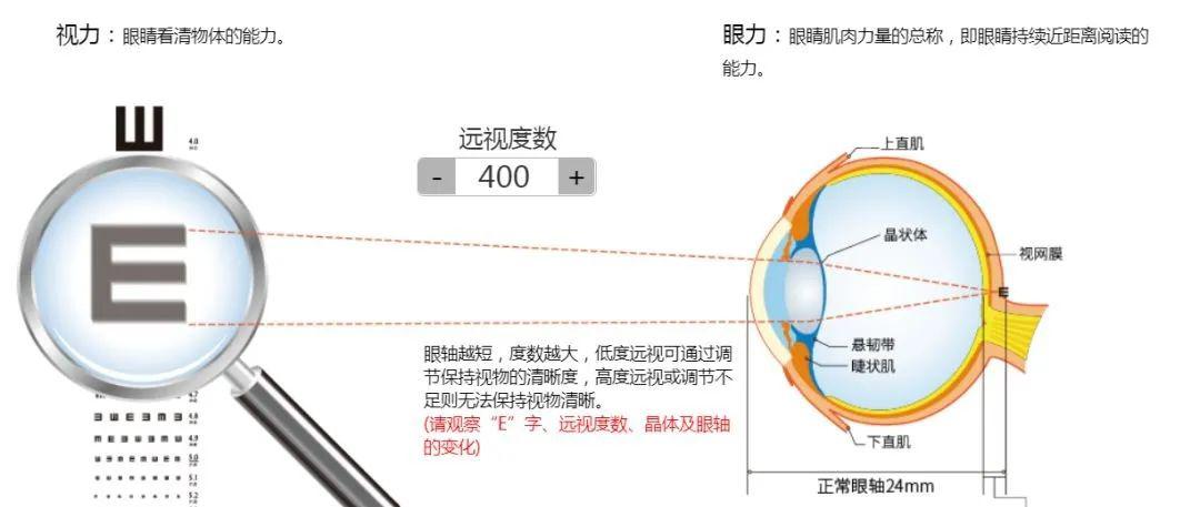 科普| 远视100度—600度所看物体清晰度,晶体及眼轴的