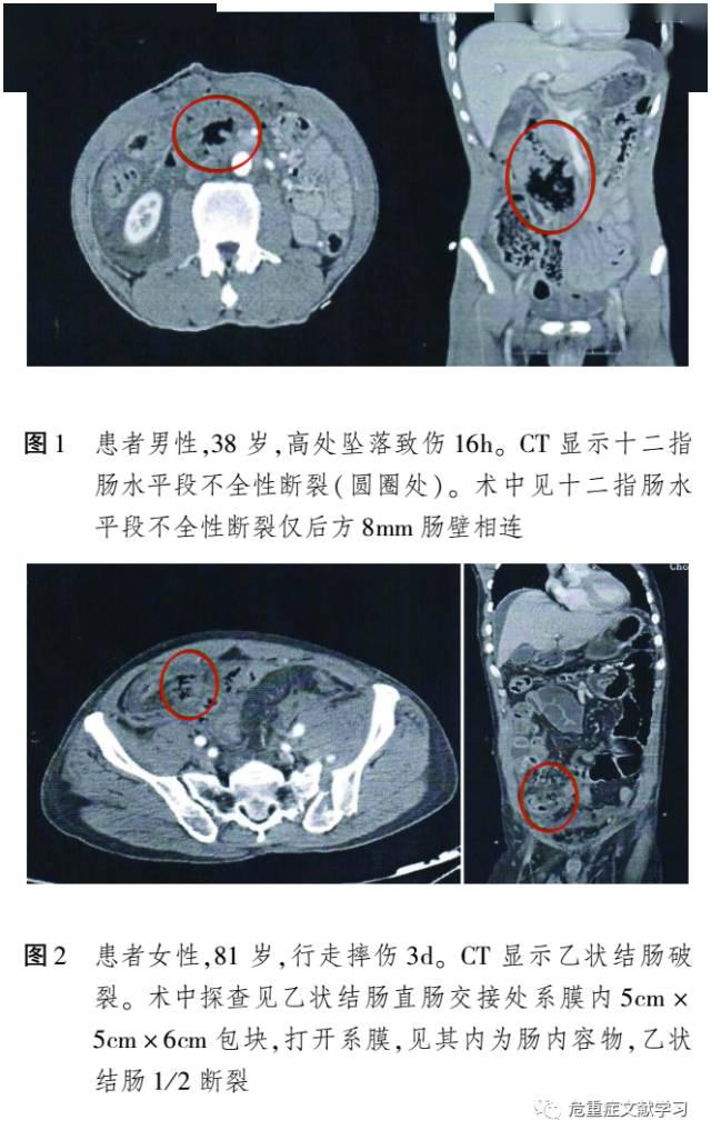 ct 检查,并获得动脉相,静脉相和延迟相图像,以明确实质性和空腔脏器的