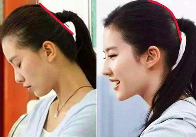 「孩子」长大后有啥差别?差距不止一点点小时候睡枕头和不睡枕头的孩子