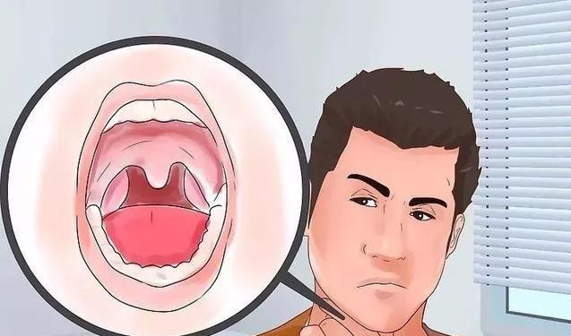 口苦是什么原因怎么回事 e1cbfe5aa9d0454291e63c4beeaae9a9.jpeg