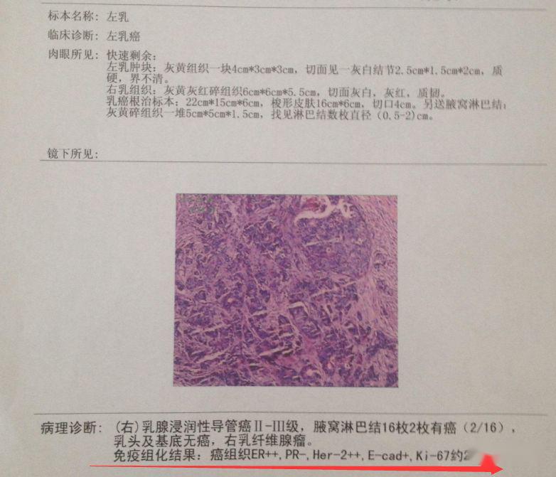 3分钟看懂病理报告