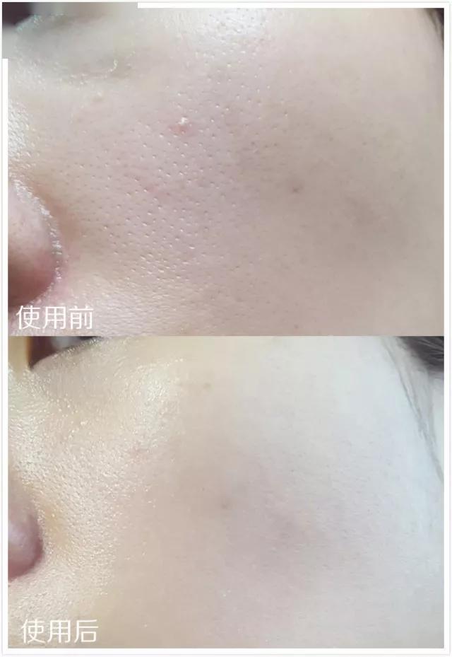 李佳琦薇娅少见同推一个品1分钟搓出老废角质脸又细又滑