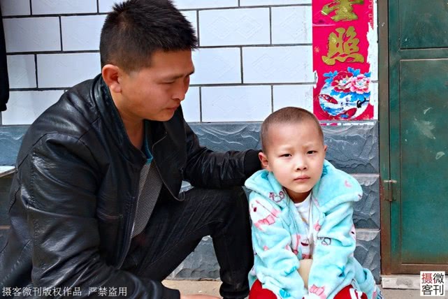 重病：照镜子后哭泣：妈妈，我是不是要死了7岁男孩患重病满头白发