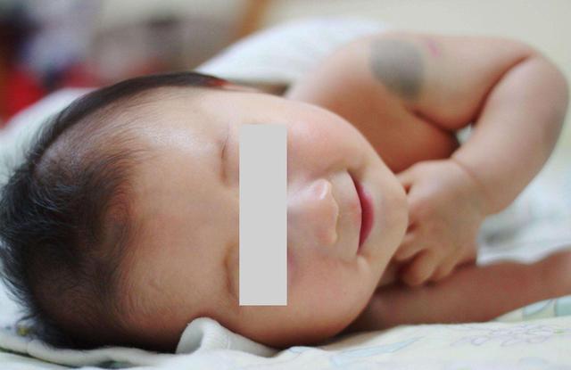 「影响」多半是妈妈孕期做了4件事宝宝出生后因胎记“毁”颜值