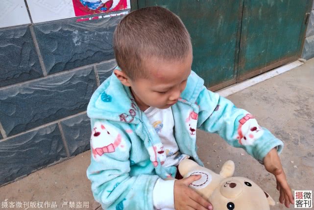 重病：照镜子后哭泣：妈妈，我是不是要死了7岁男孩患重病满头白发