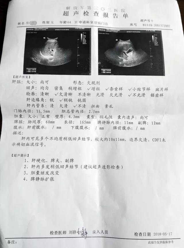 谈一谈中医针灸的奇效