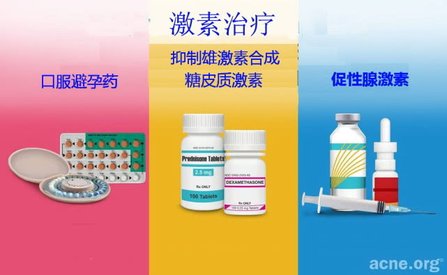 激素疗法有两种基本类型：