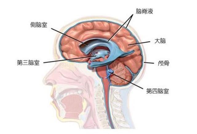 脑肿瘤和脑积水虽是两个疾病,但是关系却不一般!