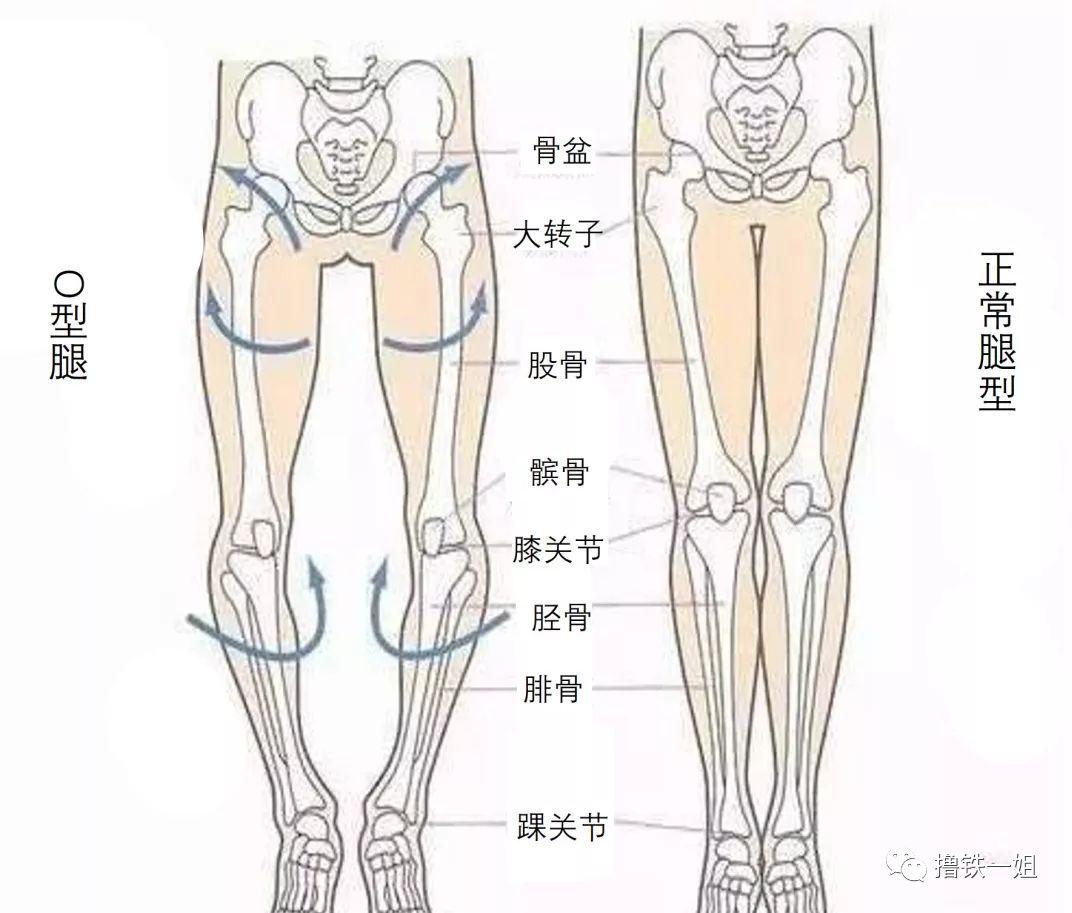 腰长加o型腿怎么搭_o型腿图片