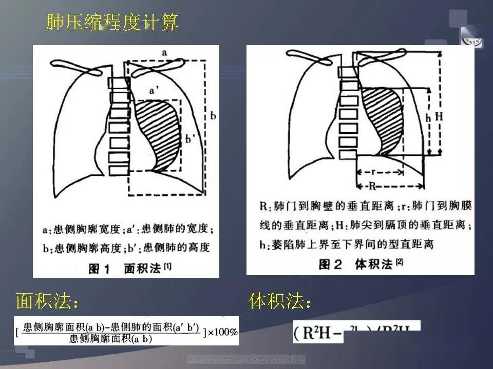 值班注意这些易误诊的气胸