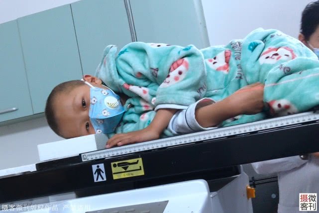 重病：照镜子后哭泣：妈妈，我是不是要死了7岁男孩患重病满头白发