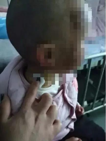 [城堡]大风掀翻充气城堡6名孩子被压！带娃出门游玩 远离这6种夺命玩具