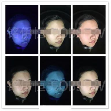 怎么测试自己是什么皮肤 fe400fccc05a48fb968c0c67aa7e2610.jpeg