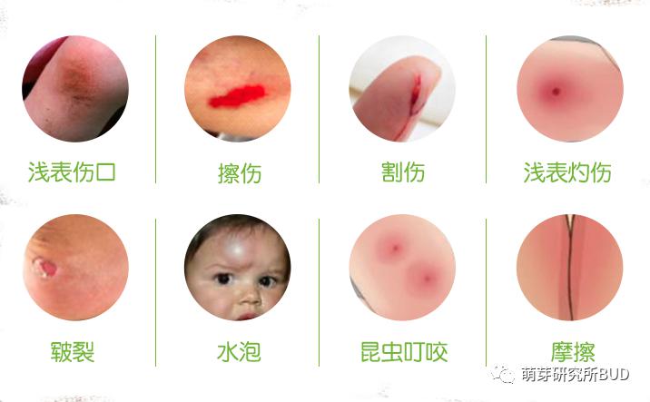 「驱蚊剂」安全有效达11小时，还有明星妈妈爱用的法国金盏花止痒膏！开团 | 2M+宝宝就能用的美国驱蚊剂