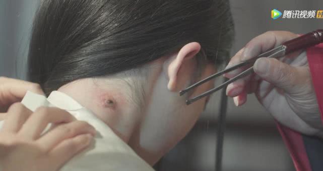 『兴来』二皇子染瘟疫，蜱虫能致命？清平乐：赵祯人到中年连失2个儿子