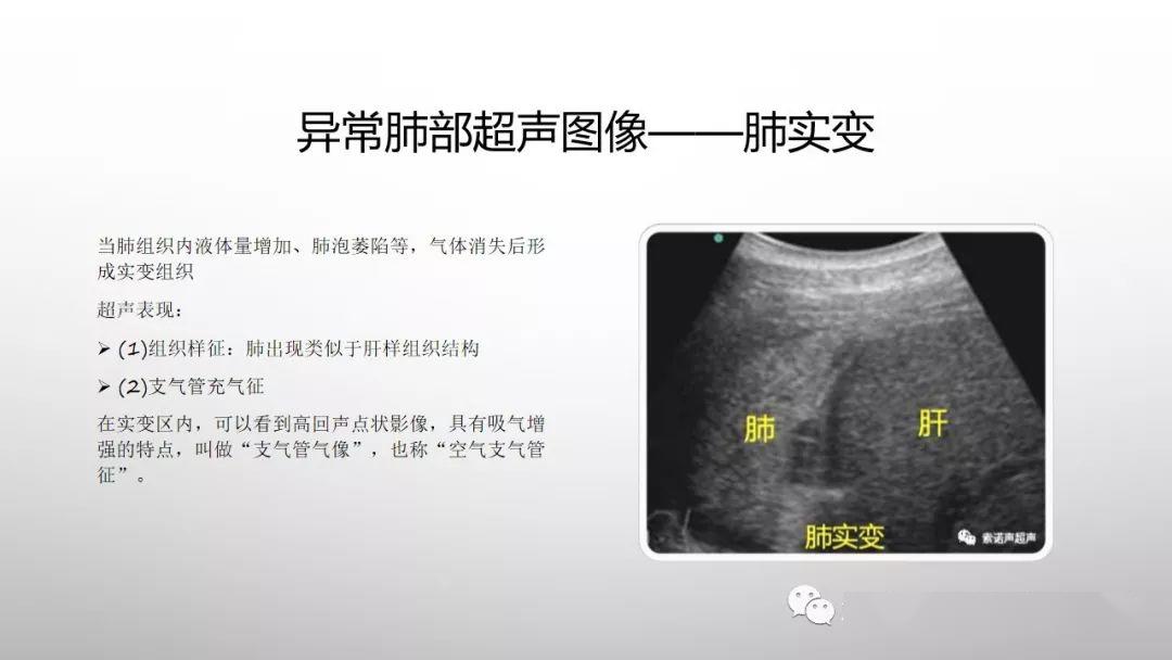 肺部超声的麻醉临床应用