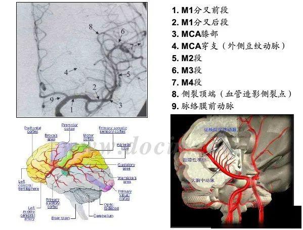 最全的颈部,脑血管图像--教你快速学会看脑血管造影片子