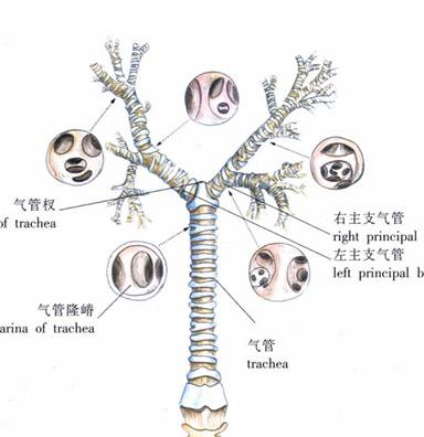喉咙里总是有痰,当心是支气管扩张!