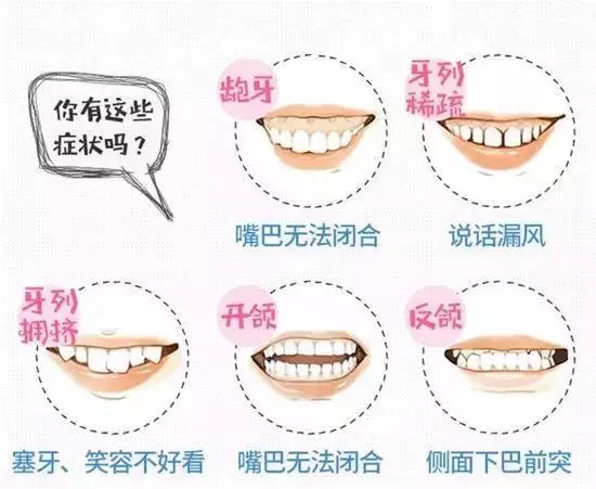 smartee正雅怎么样