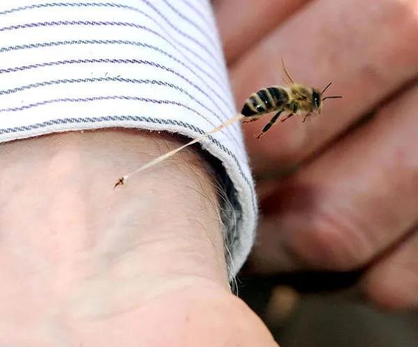 夏季蚊子叮咬只是最初级表现五一假期出游前先分清蜱虫和蜜蜂种类