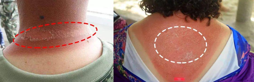 「紫外线」轻薄透气,360°防晒,整个夏天晒不黑~自带帽子和口罩的防晒衣