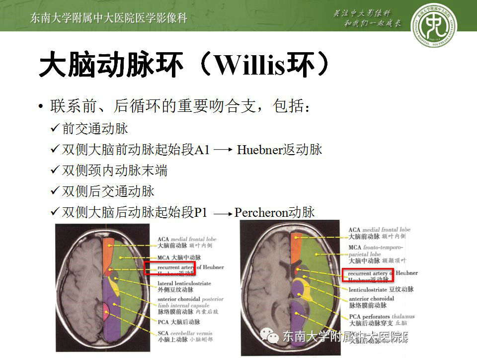 解剖 头部血管解剖及willis环常见变异