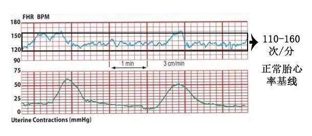 39周胎心监护不过关怎么办