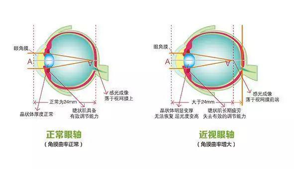 激光视网膜手术 87e33dcf488e440b8c2db24b956fd4b2.jpeg