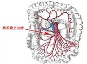 张鸿坤主任医师向刘大姐说明, 孤立性肠系膜上动脉夹层是血管急症之一